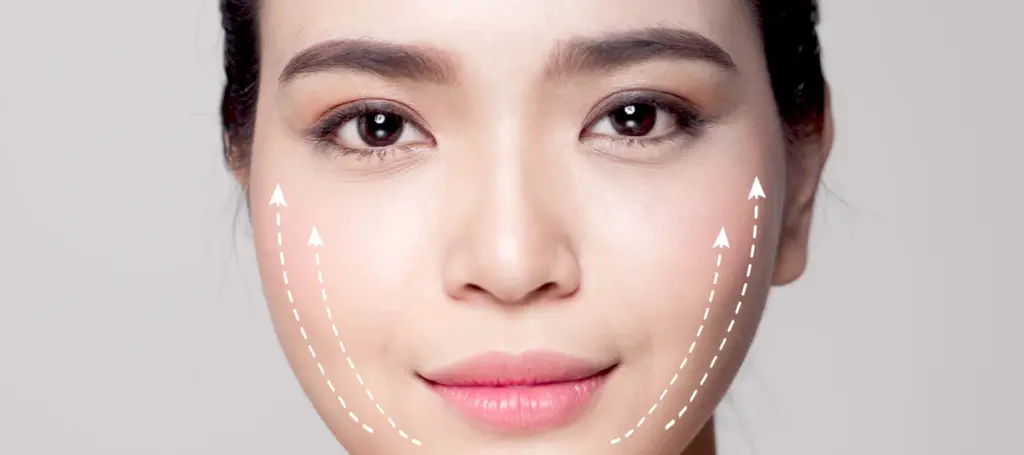 Your Guide to a PDO Thread Lift in Singapore (2025)