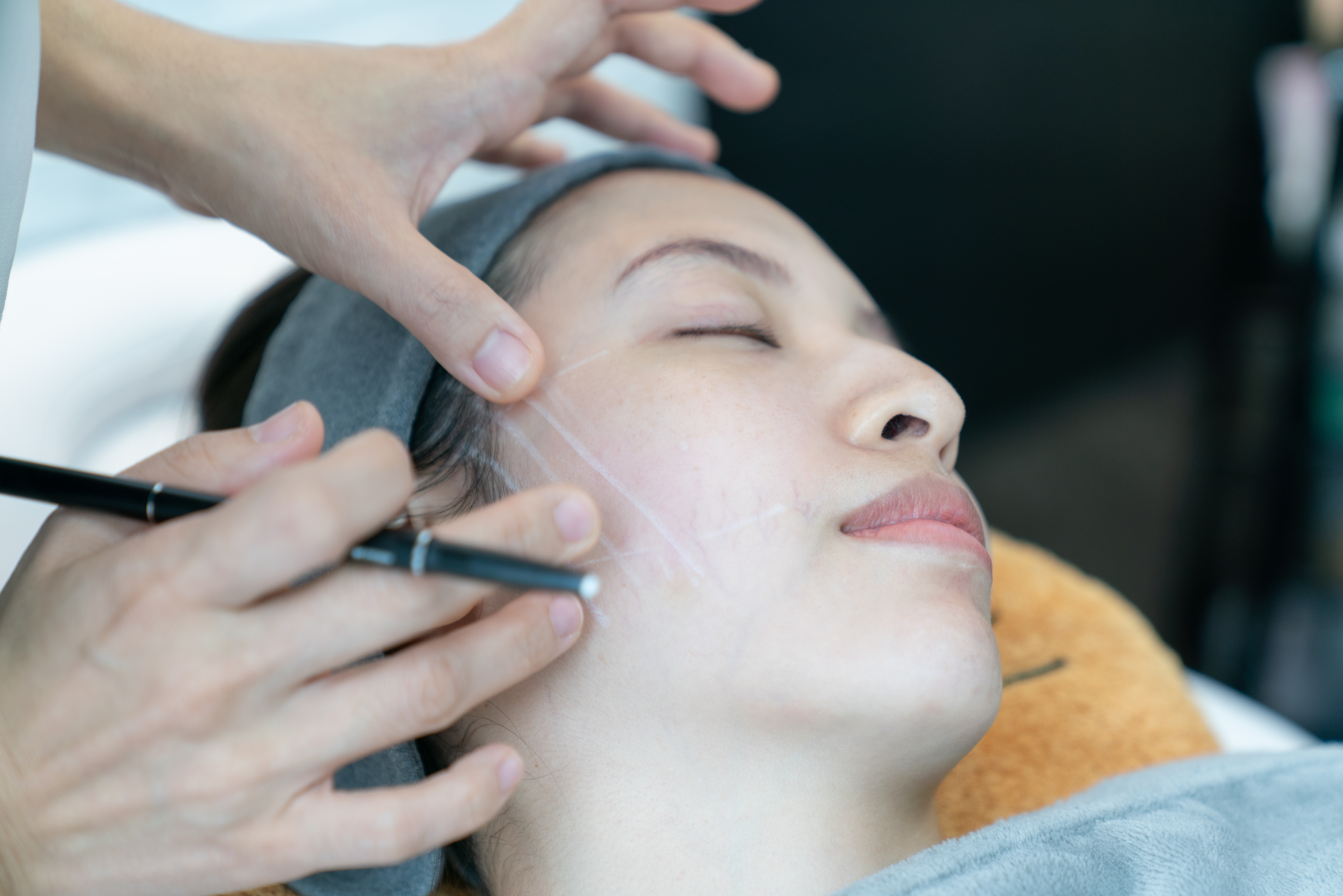 Thread Lift in Singapore: What You Need to Know